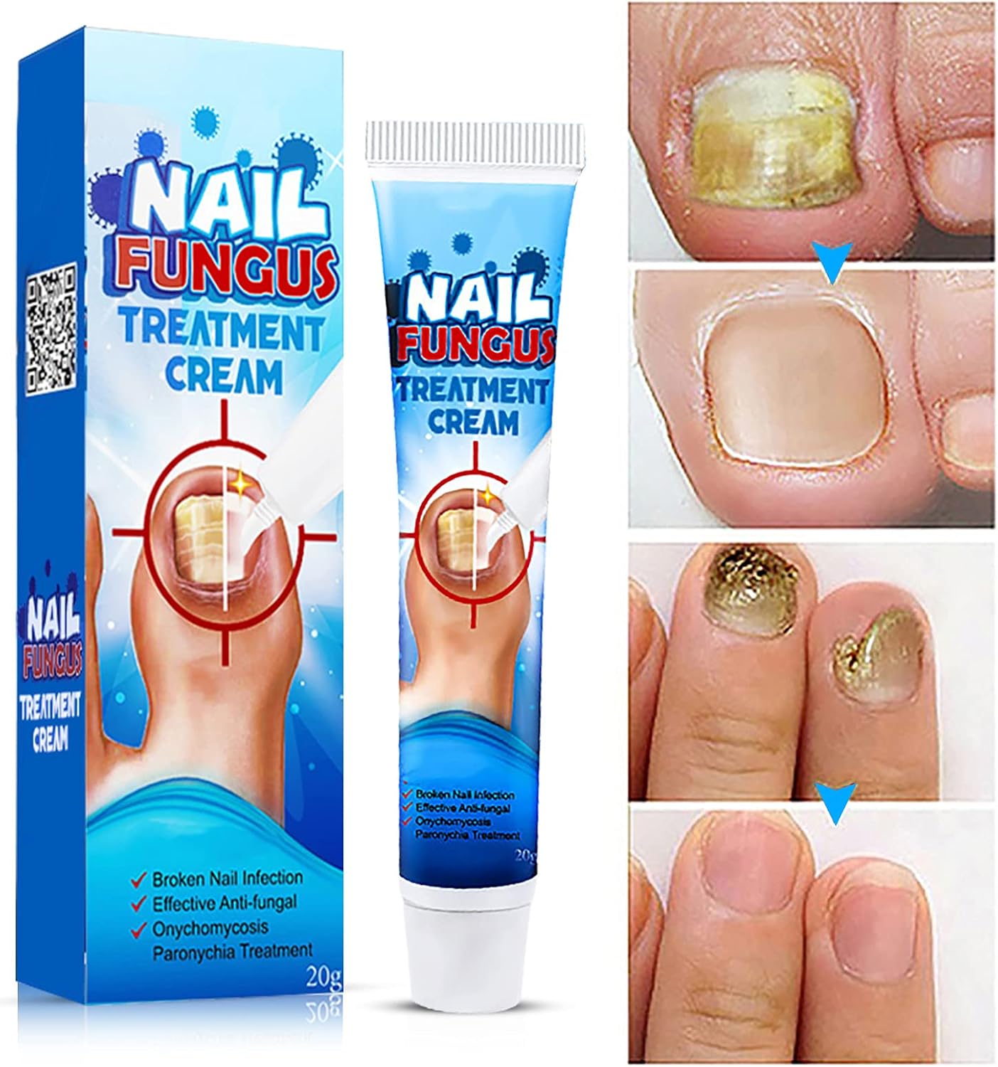 🔥 Eliminá los hongos desde la raíz en días — no semanas.